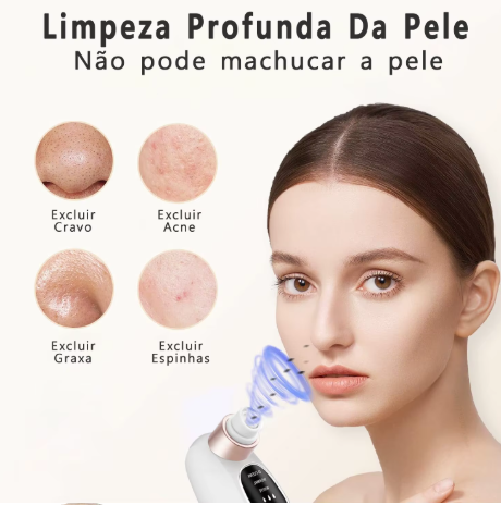 Removedor De Cravos Espinhas Sugador Poros Acne Sucção USB Recarregável