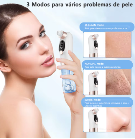 Removedor De Cravos Espinhas Sugador Poros Acne Sucção USB Recarregável