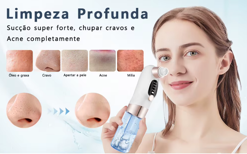 Removedor De Cravos Espinhas Sugador Poros Acne Sucção USB Recarregável